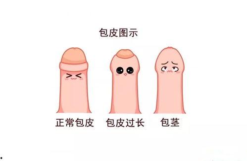 小孩做包皮手术视频,温馨守护成长第一步