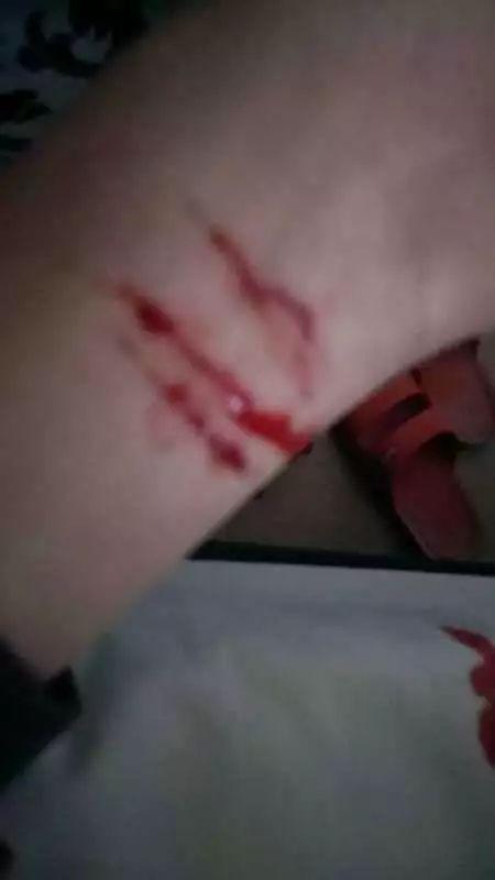 割手腕的视频,关注心理健康，远离极端行为