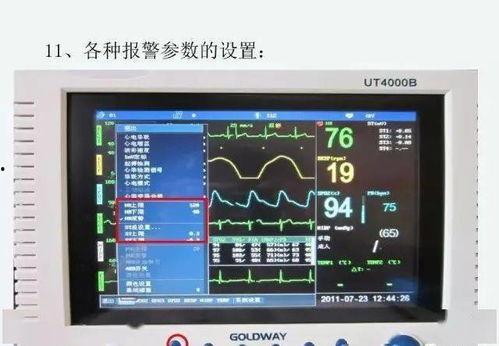 多功能监护仪操作视频